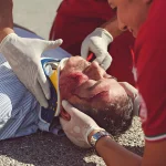 Why A Catastrophic Injury Lawyer Is Essential In Certain Cases